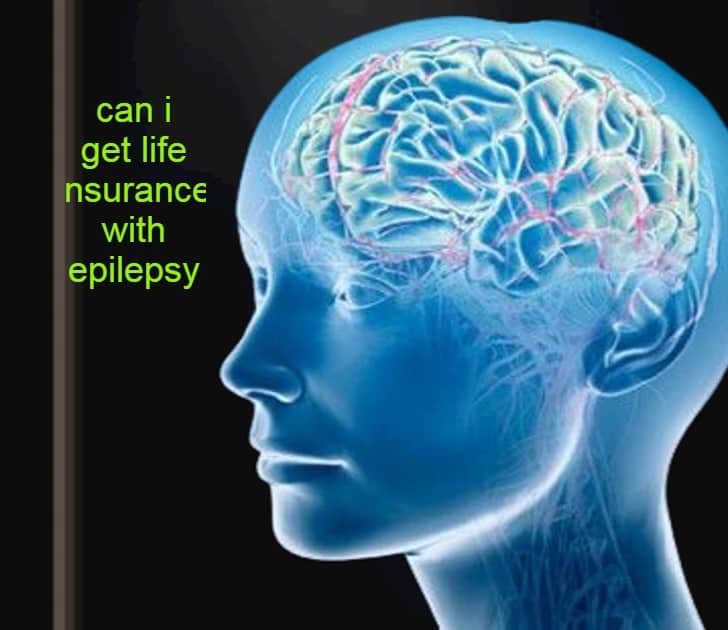 can i get life insurance with epilepsy